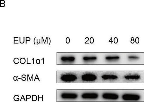 Detection of Mouse alpha -Smooth Muscle Actin by Western Blot