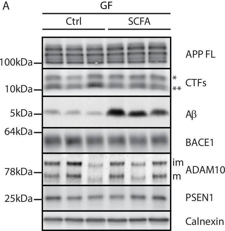 Detection of ADAM10 Ectodomain by Western Blot