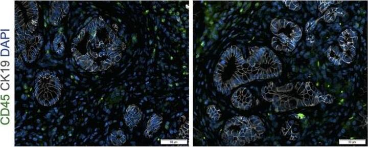 Detection of Mouse CD45 by Immunocytochemistry/ Immunofluorescence