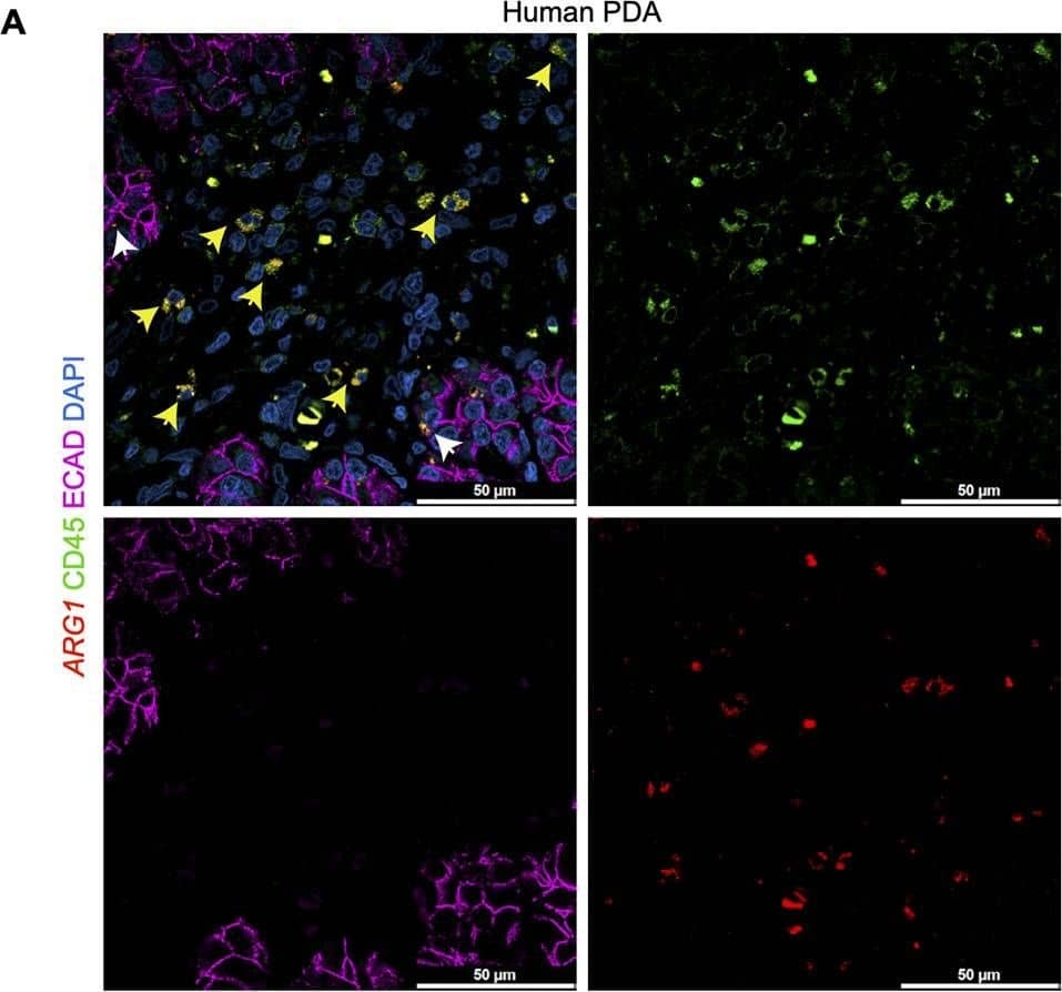 Detection of Mouse CD45 by Immunocytochemistry/ Immunofluorescence