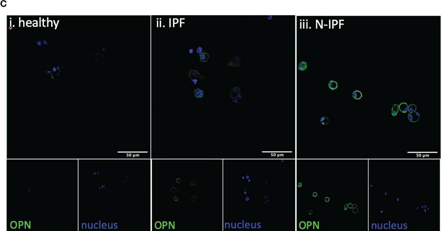 Detection of Osteopontin/OPN by Immunocytochemistry/ Immunofluorescence