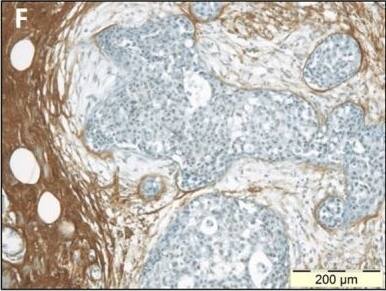 Detection of Human Decorin by Immunohistochemistry