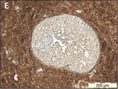 Detection of Human Decorin by Immunohistochemistry