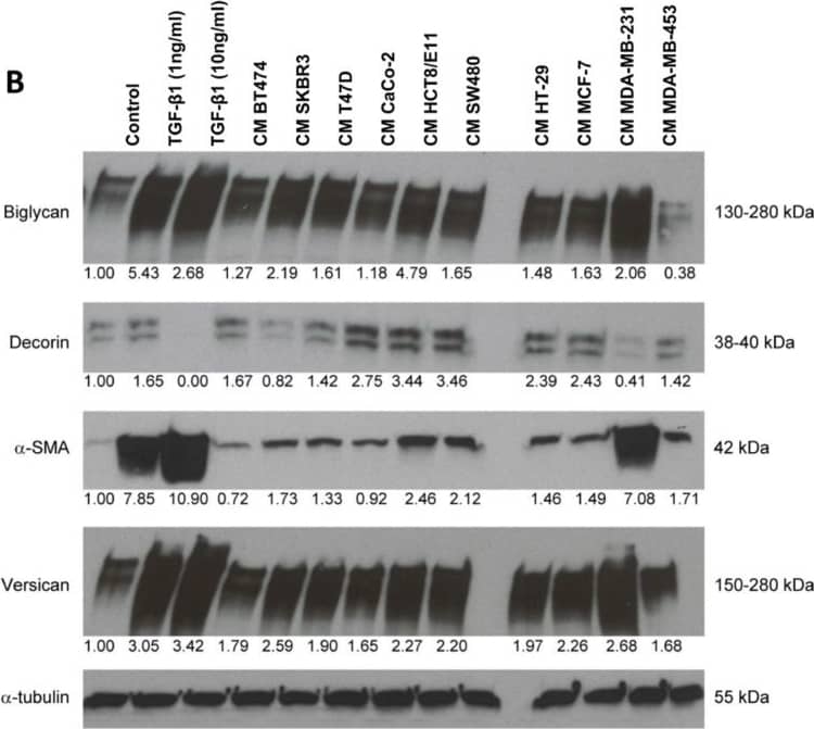 Detection of Human Decorin by Western Blot
