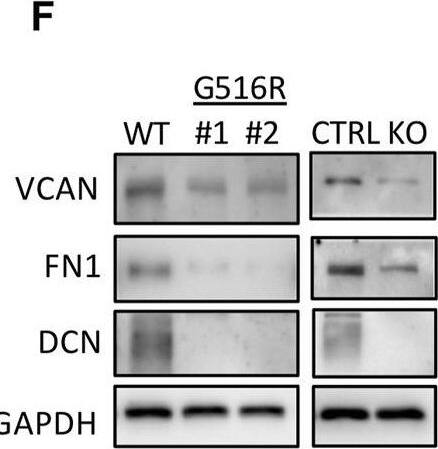 Detection of Human Decorin by Western Blot