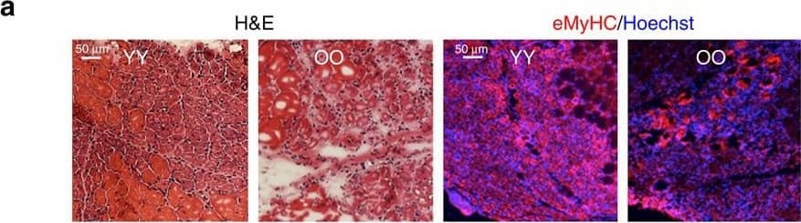 Detection of Mouse Albumin by Immunohistochemistry Detection of Mouse Albumin by Immunohistochemistry