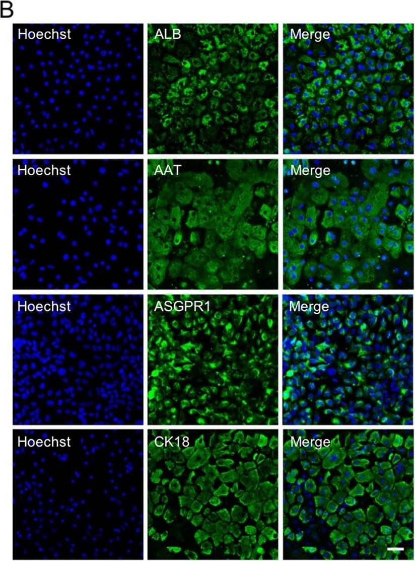 Detection of Human Albumin by Immunocytochemistry/Immunofluorescence Detection of Human Albumin by Immunocytochemistry/Immunofluorescence