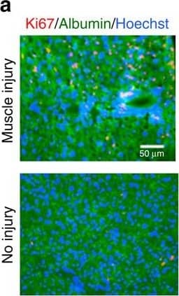 Detection of Mouse Albumin by Immunohistochemistry Detection of Mouse Albumin by Immunohistochemistry