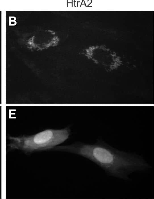 Detection of HTRA2/Omi by Immunocytochemistry/ Immunofluorescence