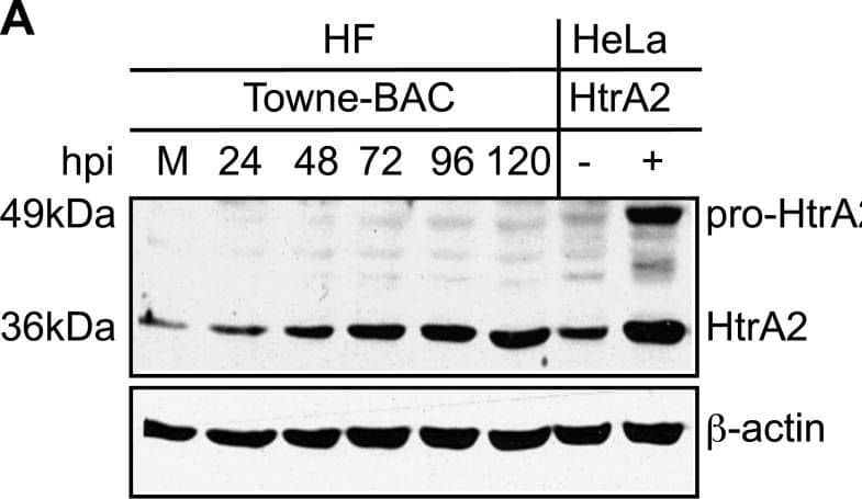 Detection of HTRA2/Omi by Western Blot