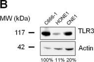 Detection of TLR3 by Western Blot