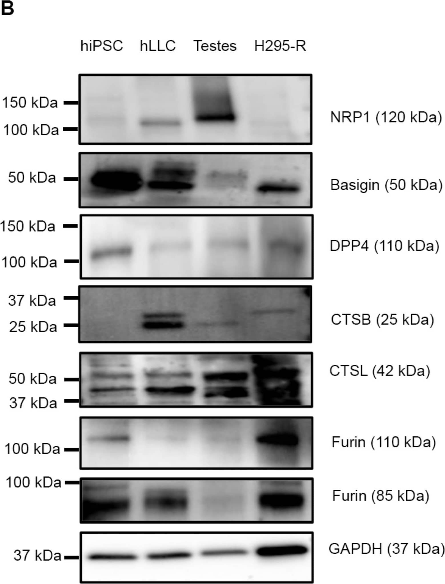 Detection of Furin by Western Blot