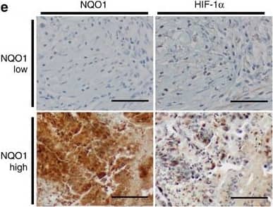 Detection of Human HIF-1 alpha by Immunohistochemistry