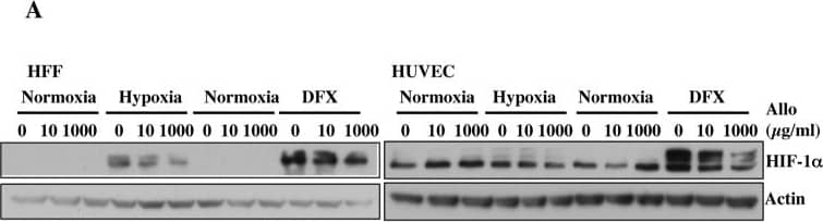 Detection of Human HIF-1 alpha by Western Blot