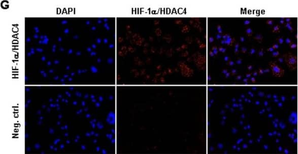 Detection of Human HIF-1 alpha by Immunocytochemistry/Immunofluorescence