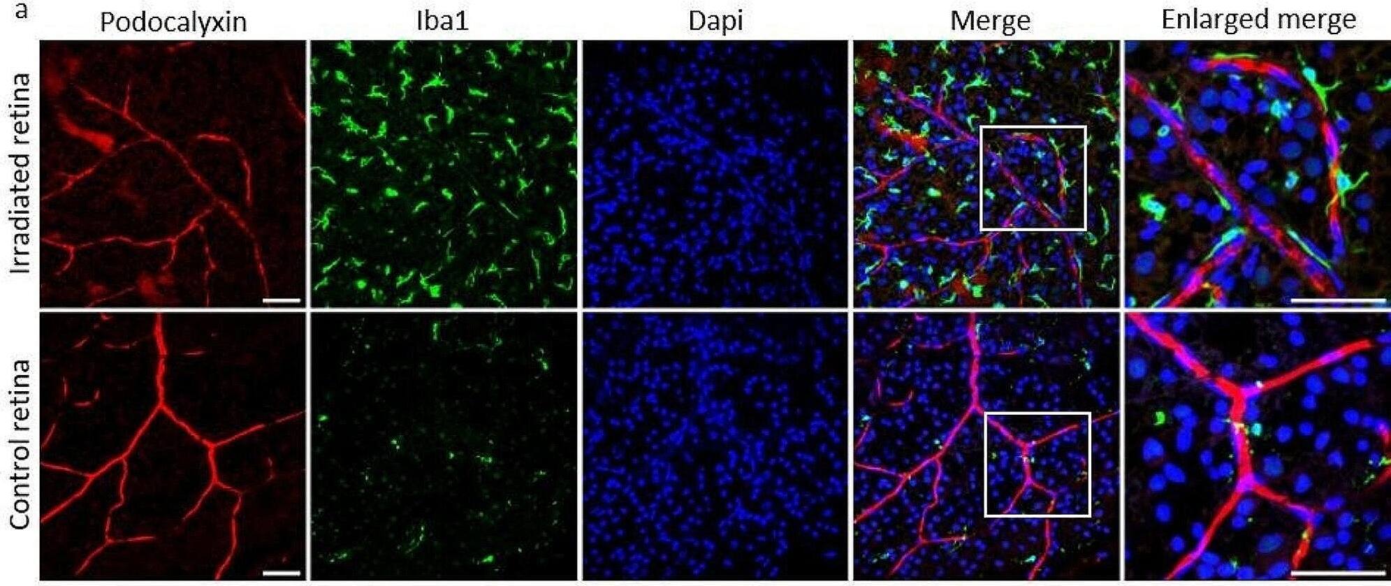 Detection of Podocalyxin by Immunohistochemistry