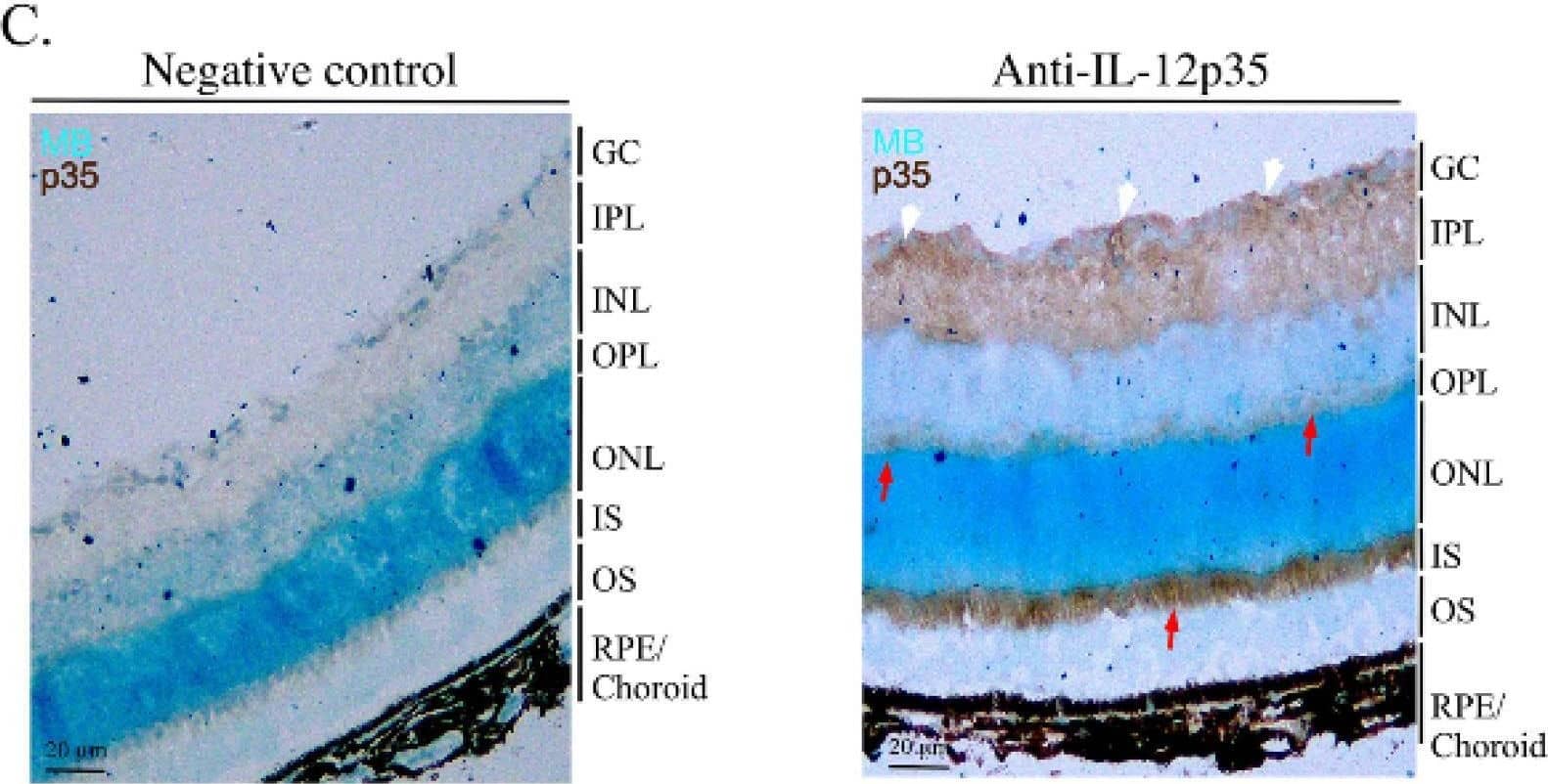 Detection of IL-12/IL-35 p35 by Immunohistochemistry