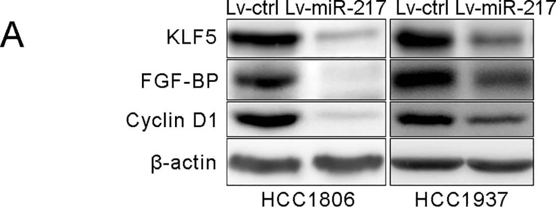 Detection of Human FGF-BP by Western Blot