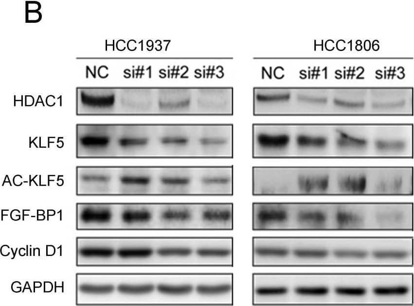 Detection of FGF-BP by Western Blot