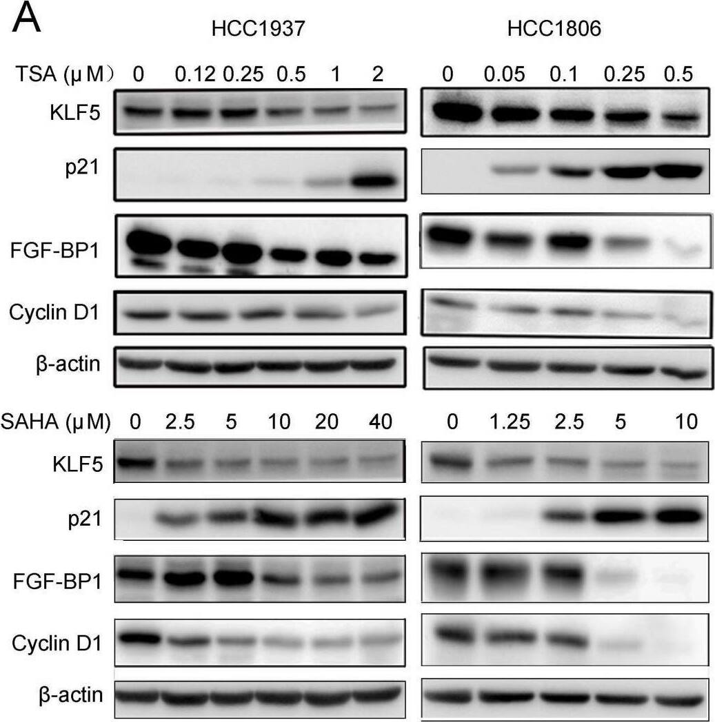 Detection of FGF-BP by Western Blot