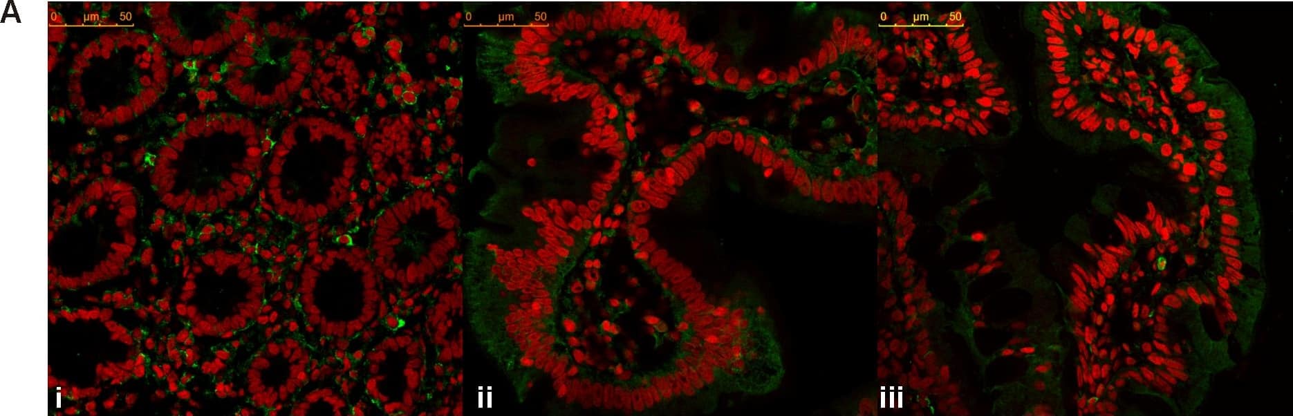 Detection of Human CXCR3 by Immunocytochemistry/Immunofluorescence