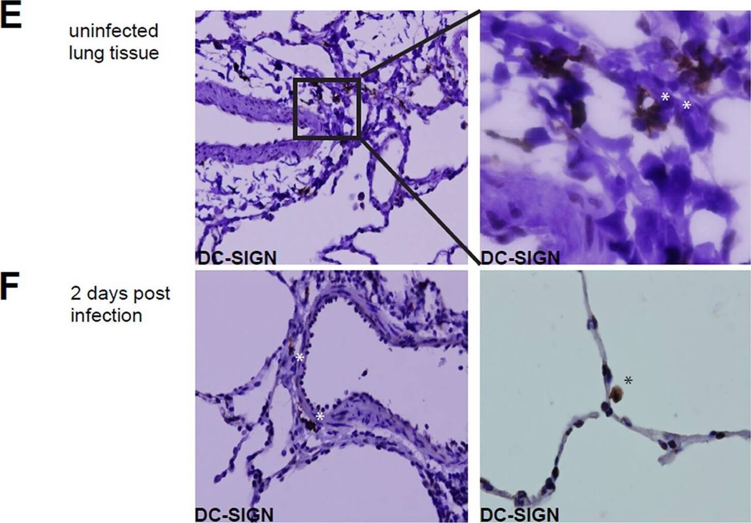 Detection of DC-SIGN/CD209 by Immunohistochemistry Detection of DC-SIGN/CD209 by Immunohistochemistry