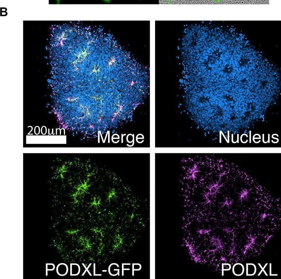 Detection of Podocalyxin by Immunocytochemistry/ Immunofluorescence