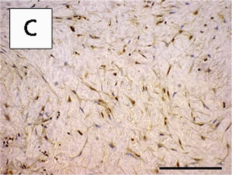 Detection of Human HMGB1/HMG-1 by Immunohistochemistry