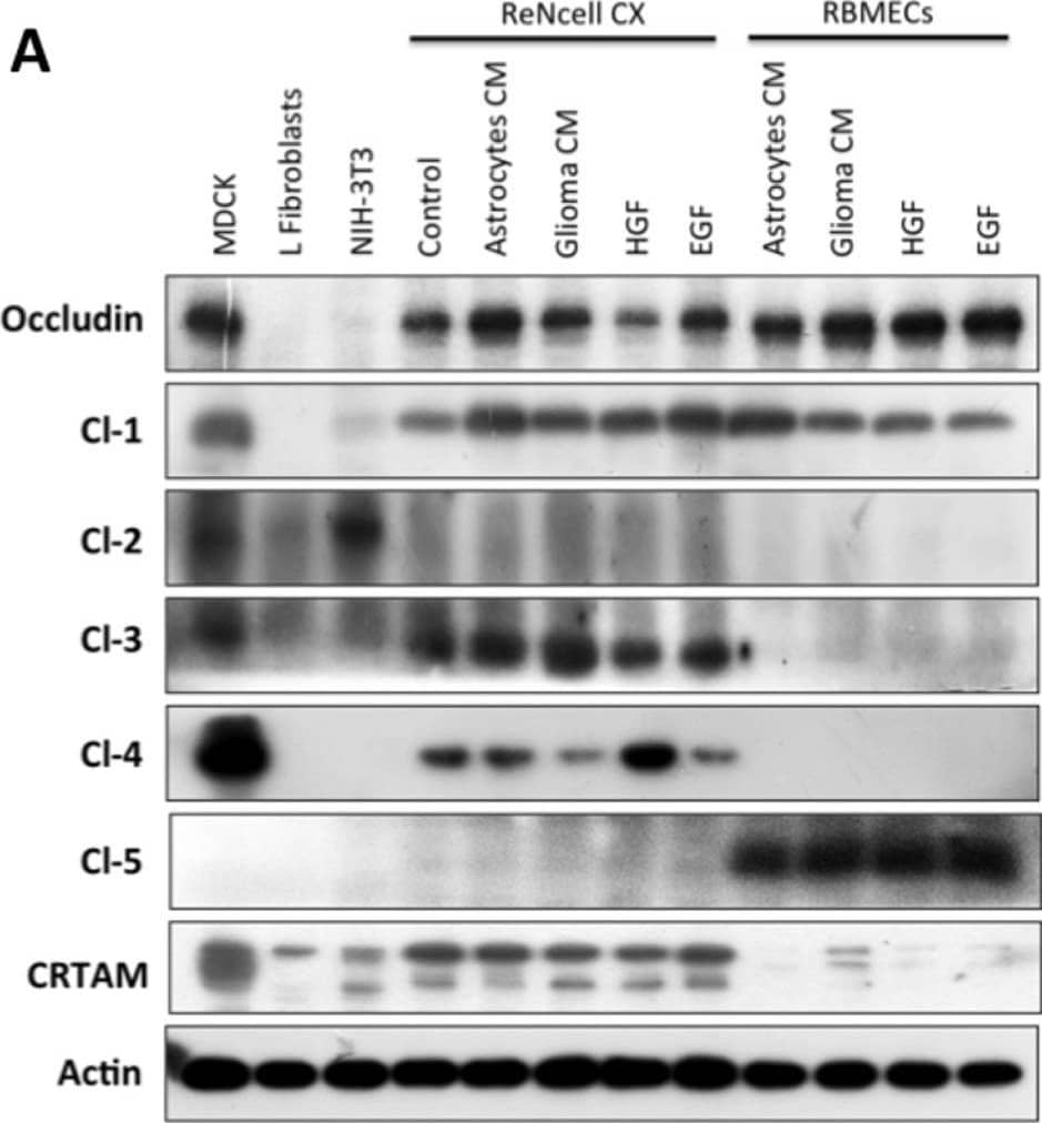 Detection of CRTAM by Western Blot