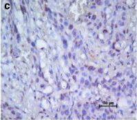 Detection of Human CXCR4 by Immunohistochemistry