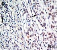 Detection of Human CXCR4 by Immunohistochemistry