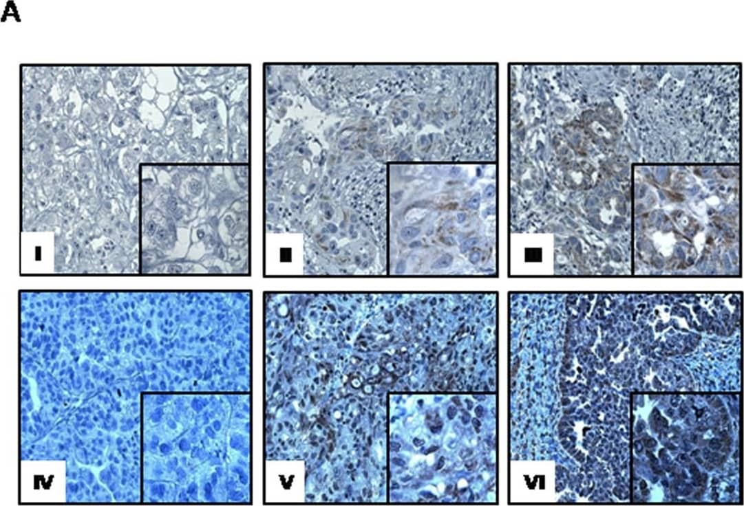 Detection of Human CXCR4 by Immunohistochemistry