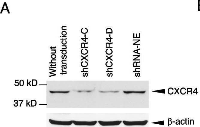 Detection of CXCR4 by Western Blot