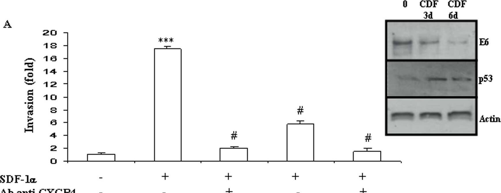 Detection of CXCR4 by Western Blot