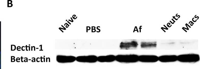 Detection of Dectin-1/CLEC7A by Western Blot