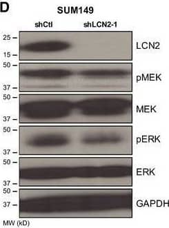 Detection of Lipocalin-2/NGAL by Western Blot