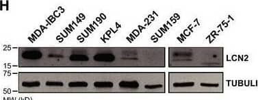 Detection of Lipocalin-2/NGAL by Western Blot