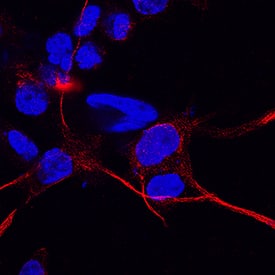 CD83 antibody in THP-1 Human Cell Line by Immunocytochemistry (ICC).