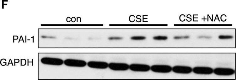 Detection of Serpin E1/PAI-1 by Western Blot