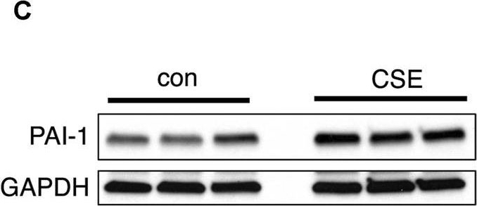 Detection of Serpin E1/PAI-1 by Western Blot