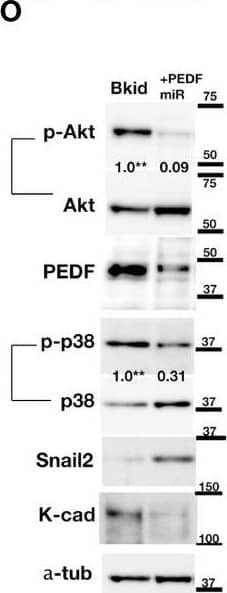Detection of Human Cadherin-11 by Western Blot