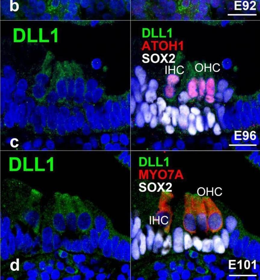 Detection of DLL1 by Immunohistochemistry