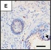 Detection of Human CCR5 by Immunohistochemistry