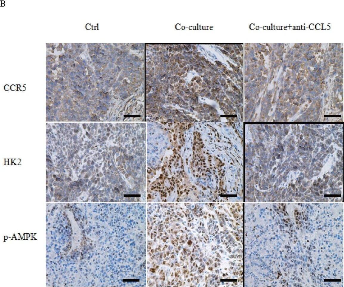 Detection of Human CCR5 by Immunohistochemistry