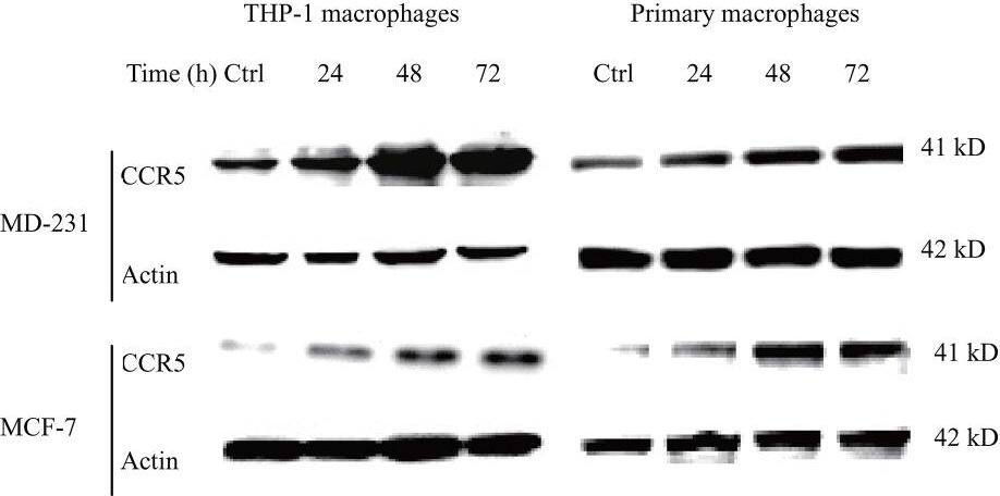 Detection of Human CCR5 by Western Blot