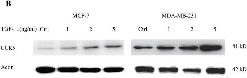 Detection of Human CCR5 by Western Blot