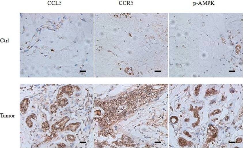 Detection of Human CCR5 by Immunohistochemistry