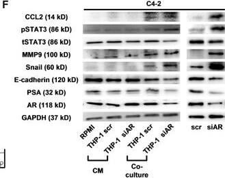 Detection of E-Cadherin by Western Blot