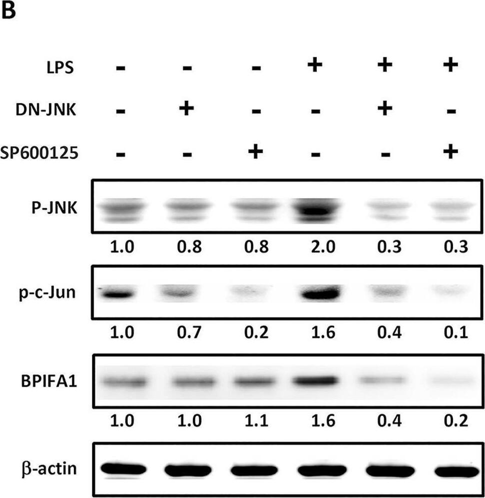Detection of PLUNC by Western Blot
