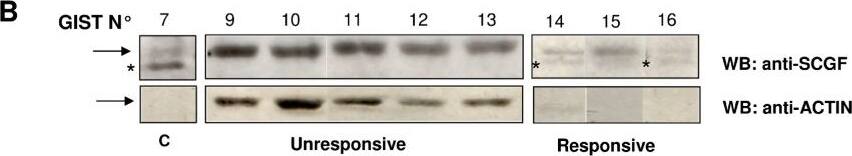 Detection of Human Human SCGF/CLEC11a Antibody by Western Blot